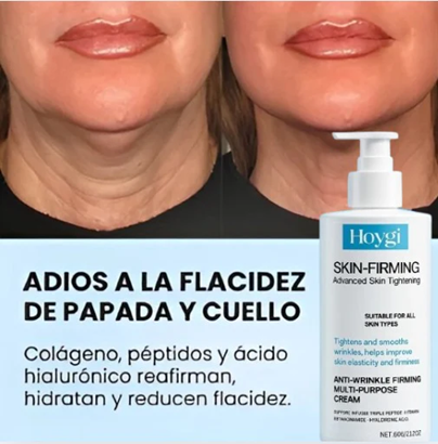 HOYGI™ Skin-Firming | Crema Reafirmante 🍀